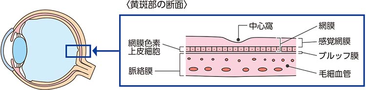 加齢黄斑変性画像